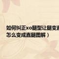 如何纠正xo腿型让腿变直（xo怎么变成直腿图解）